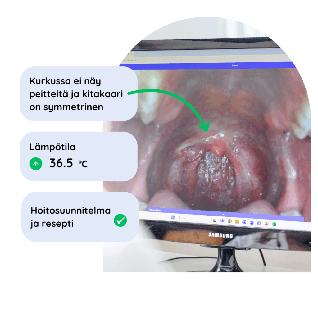 Kuva tietokoneelta, jossa näkyy potilaan nielu kuvattuna.